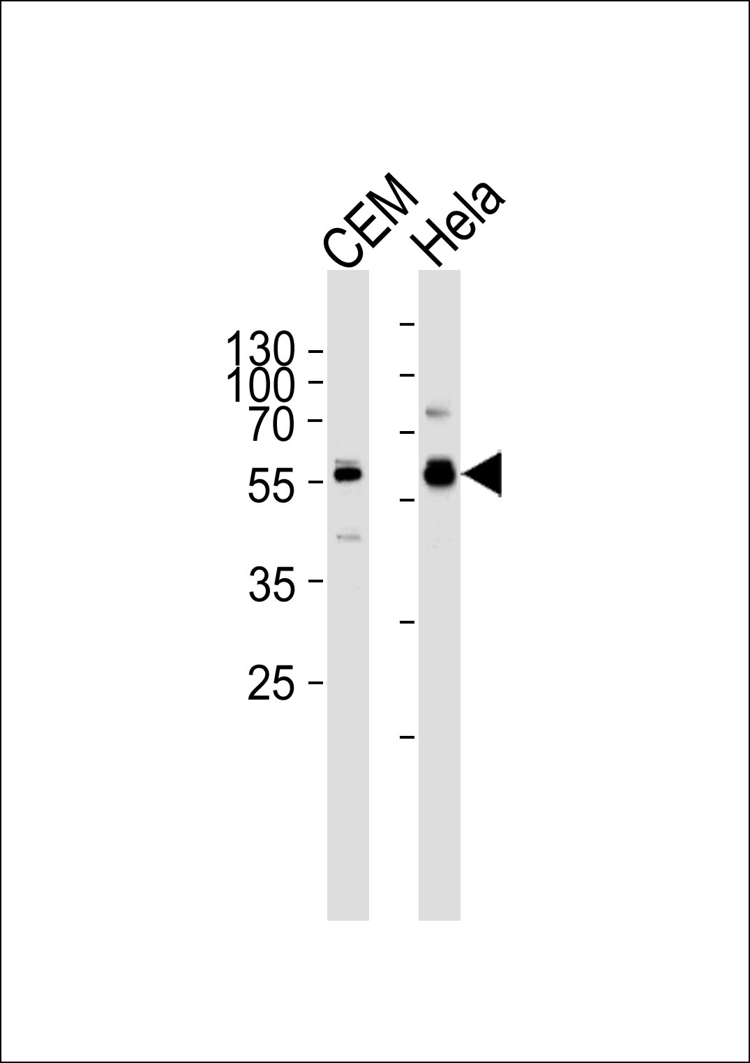 WB - DYRK2 Antibody (N-term) AP7534a