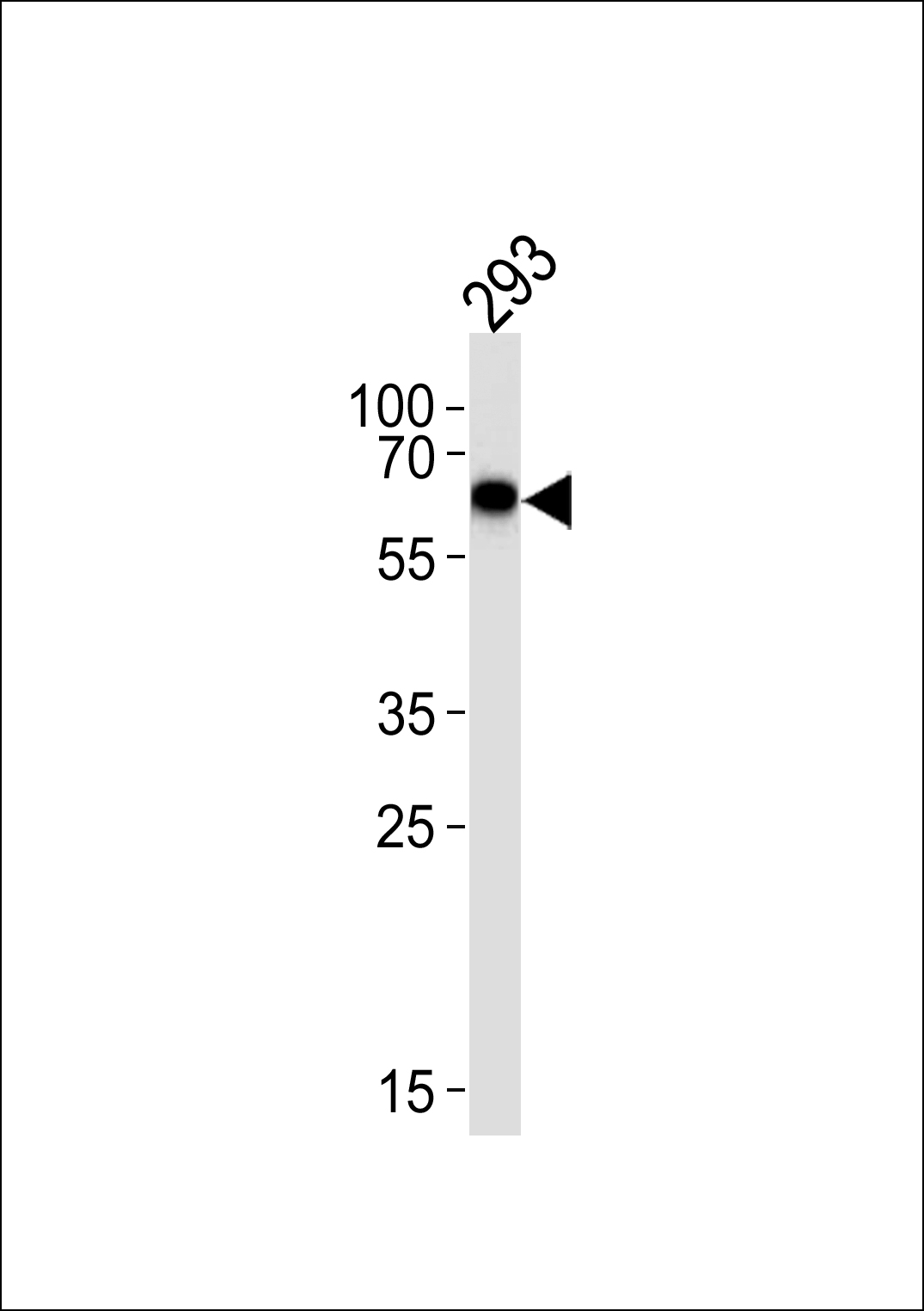 Western blot analysis of lysate from 293 cell line,  using SPAK Antibody (A363)(Cat.  #AP7968c).  AP7968c was diluted at 1:1000 at each lane.  A goat anti-rabbit IgG H&L(HRP) at 1:5000 dilution was used as the secondary antibody.  Lysate at 35ug.