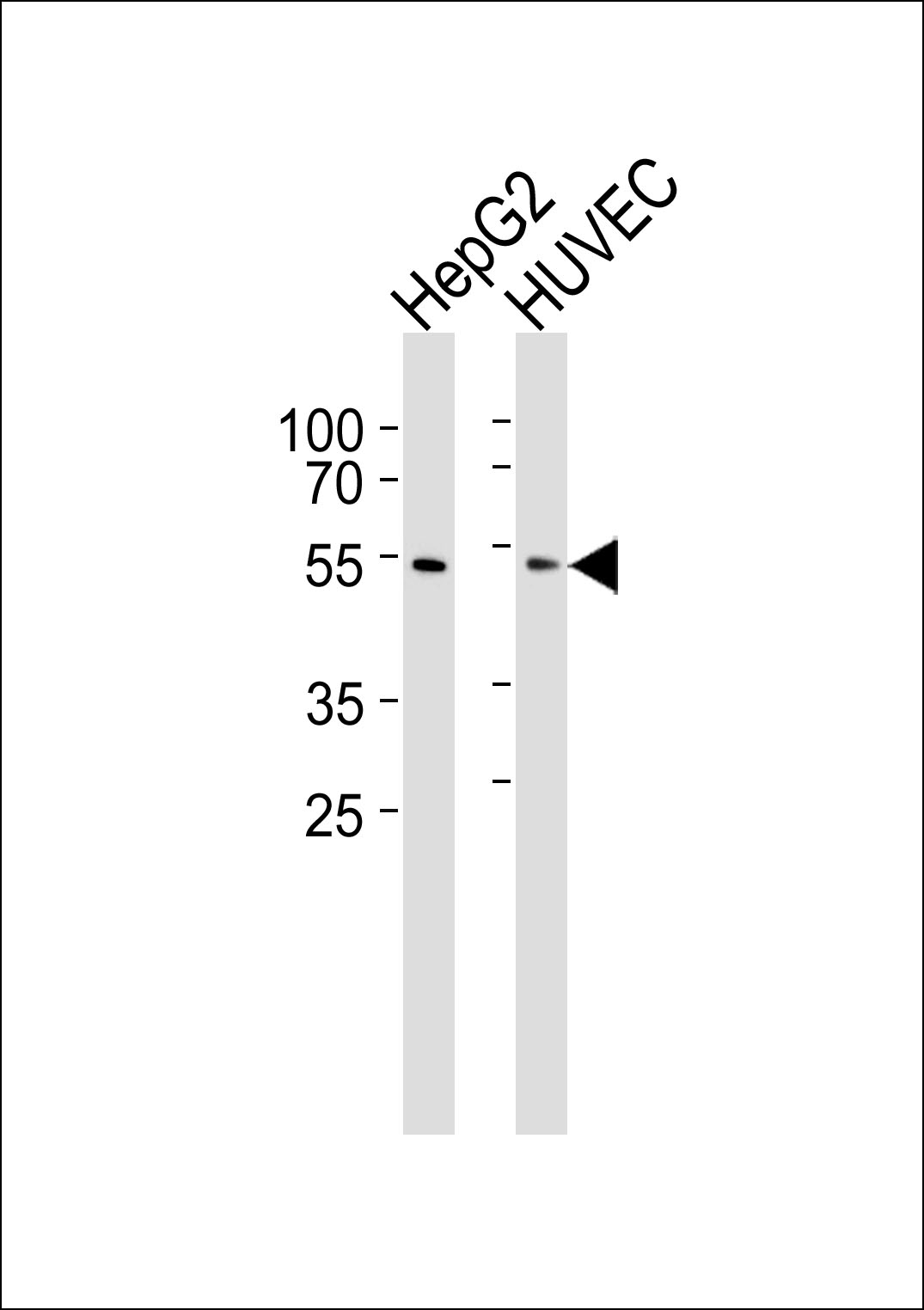 Western blot analysis of lysates from HepG2, HUVEC cell line (from left to right), using SUV39H2 Antibody (K48)(Cat.  #AP1281A).  AP1281A was diluted at 1:1000 at each lane.  A goat anti-rabbit IgG H&L(HRP) at 1:5000 dilution was used as the secondary antibody. Lysates at 35ug per lane.