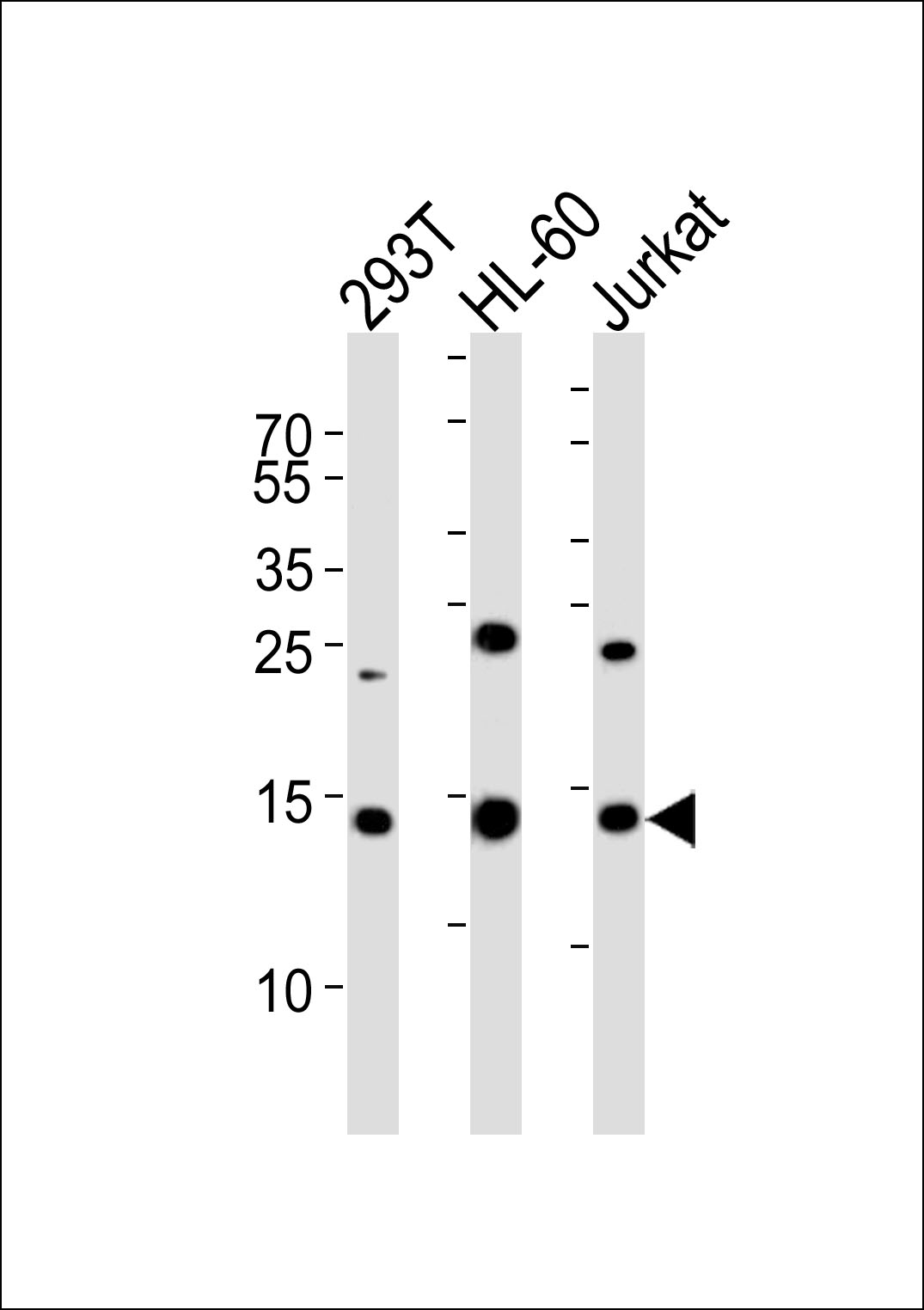 WB - SUMO2 Antibody (C-term) AP1282a