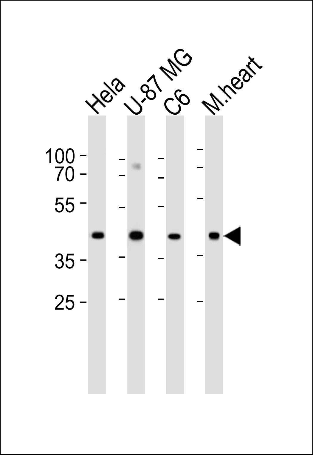 Western blot analysis of lysates from Hela, U-87 MG, C6 cell line and mouse heart tissue lysate (from left to right), using GJA1 Antibody (N121)(Cat.  #AP1541b). AP1541b was diluted at 1:1000 at each lane.  A goat anti-rabbit IgG H&L(HRP) at 1:5000 dilution was used as the secondary antibody. Lysates at 35ug per lane.