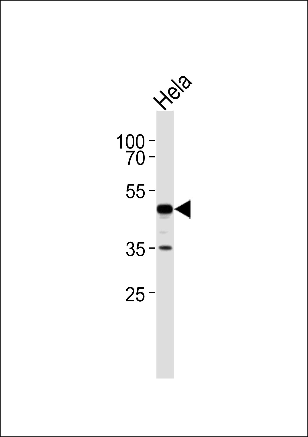 WB - ERI1 Antibody AP50075
