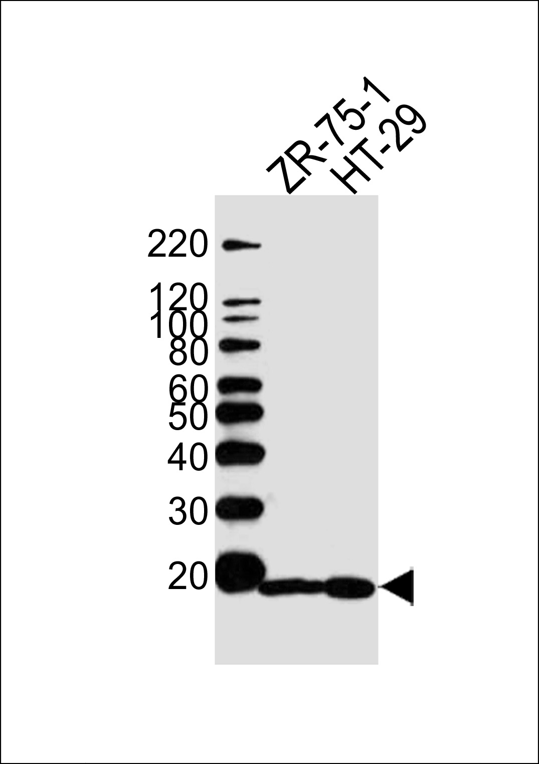 WB - AGR2 Antibody (Center) AP6279c