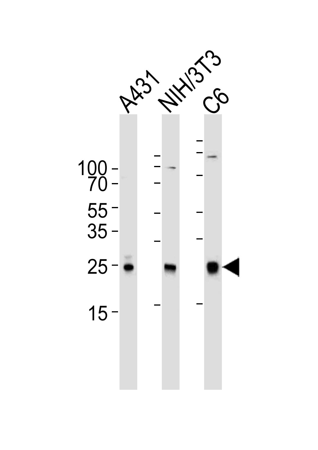 Western blot analysis of lysates from A431, mouse NIH/3T3, rat C6 cell line (from left to right), using RAC1 Antibody(Cat.  #AM8434b).  AM8434b was diluted at 1:1000 at each lane.  A goat anti-mouse IgG H&L(HRP) at 1:3000 dilution was used as the secondary antibody. Lysates at 35?g per lane.