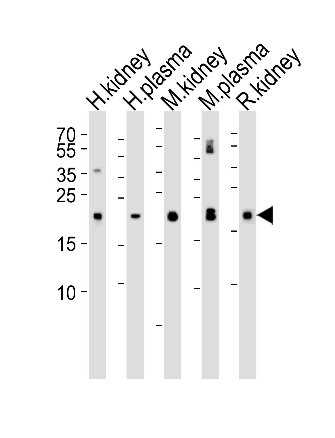 Western blot analysis of lysates from human kidney, plasma, mouse kidney, plasma and rat kidney tissue lysate(from left to right), using GPX3 Antibody (Center)(Cat.  #AP11221c).  AP11221c was diluted at 1:1000 at each lane.  A goat anti-rabbit IgG H&L(HRP) at 1:5000 dilution was used as the secondary antibody. Lysates at 35ug per lane.