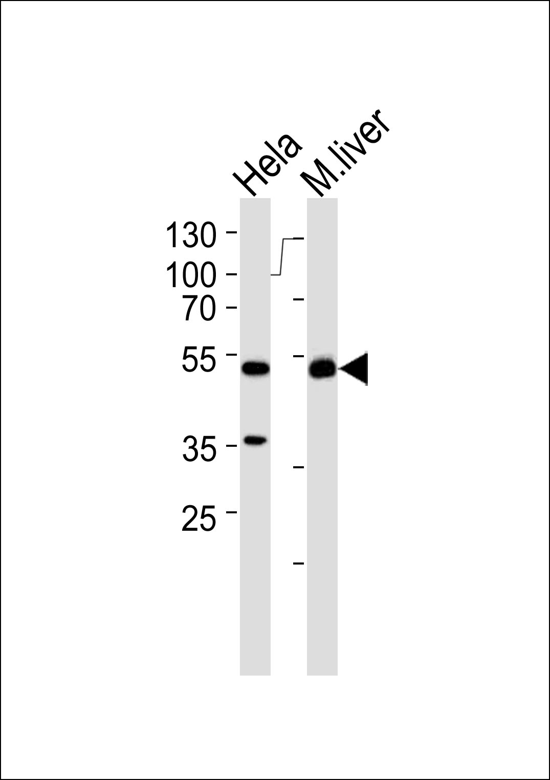 Western blot analysis of lysates from Hela cell line and mouse liver tissue lysate(from left to right), using APG4C Antibody (N434?(Cat.  #AP1810C).  AP1810C was diluted at 1:1000 at each lane.  A goat anti-rabbit IgG H&L(HRP) at 1:5000 dilution was used as the secondary antibody. Lysates at 35ug per lane.