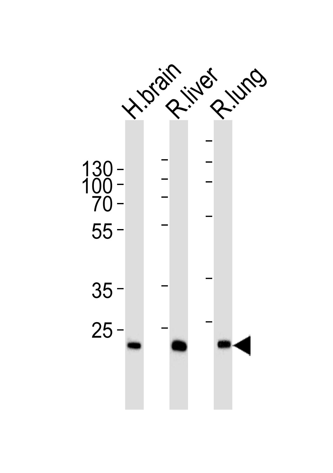 Western blot analysis of lysates from human brain , rat liver and lung tissue lysate (from left to right), using GSTT1 Antibody (N-term)(Cat.  #AP20614a).  AP20614a was diluted at 1:1000 at each lane.  A goat anti-rabbit IgG H&L(HRP) at 1:5000 dilution was used as the secondary antibody. Lysates at 35ug per lane.