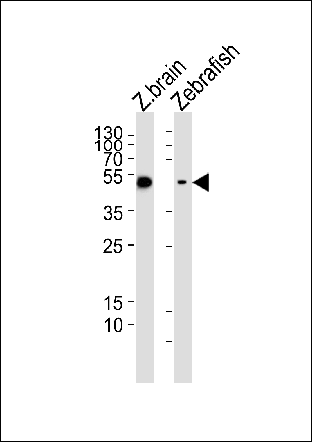 Western blot analysis of lysates from zebrafish brain,  Zebrafish tissue lysate (from left to right),  using (DANRE) gfap Antibody (N-term)(Cat.   #AP20618a).   AP20618a was diluted at 1:1000 at each lane.   A goat anti-rabbit IgG H&L(HRP) at 1:5000 dilution was used as the secondary antibody.  Lysates at 35ug per lane.