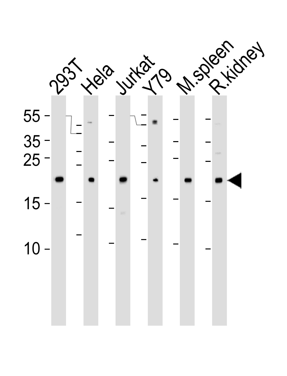 Western blot analysis of lysates from 293T, Hela, Jurkat, Y79 cell line , mouse spleen and rat kidney tissue lysate(from left to right), using DHFR Antibody (N-term)(Cat.  #AP20626a).  AP20626a was diluted at 1:1000 at each lane.  A goat anti-rabbit IgG H&L(HRP) at 1:5000 dilution was used as the secondary antibody. Lysates at 35ug per lane.