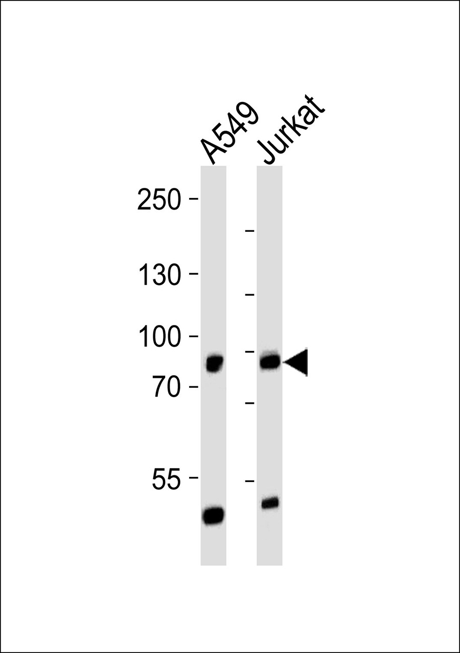 WB - PNPLA8 Antibody AP50621