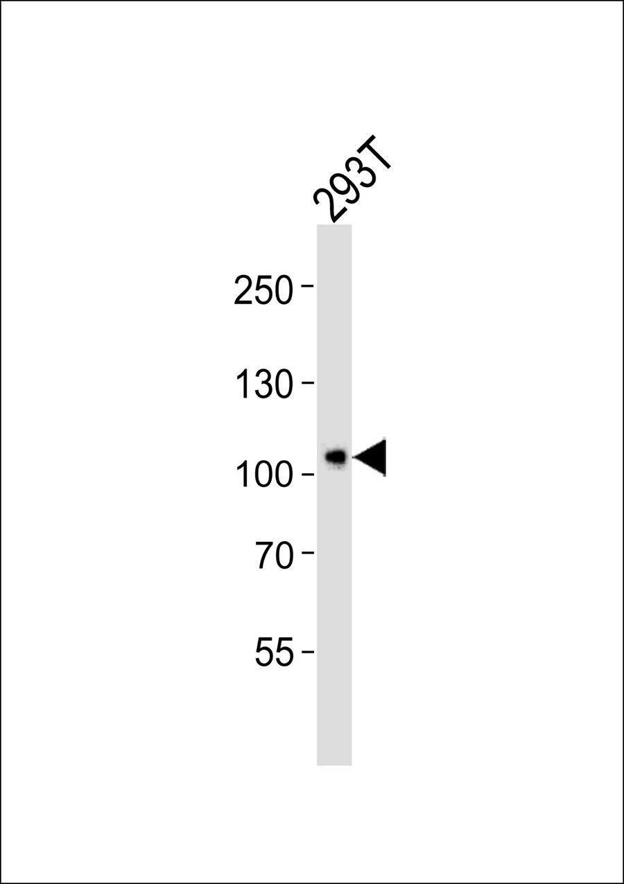 WB - NARG1 Antibody AP50688
