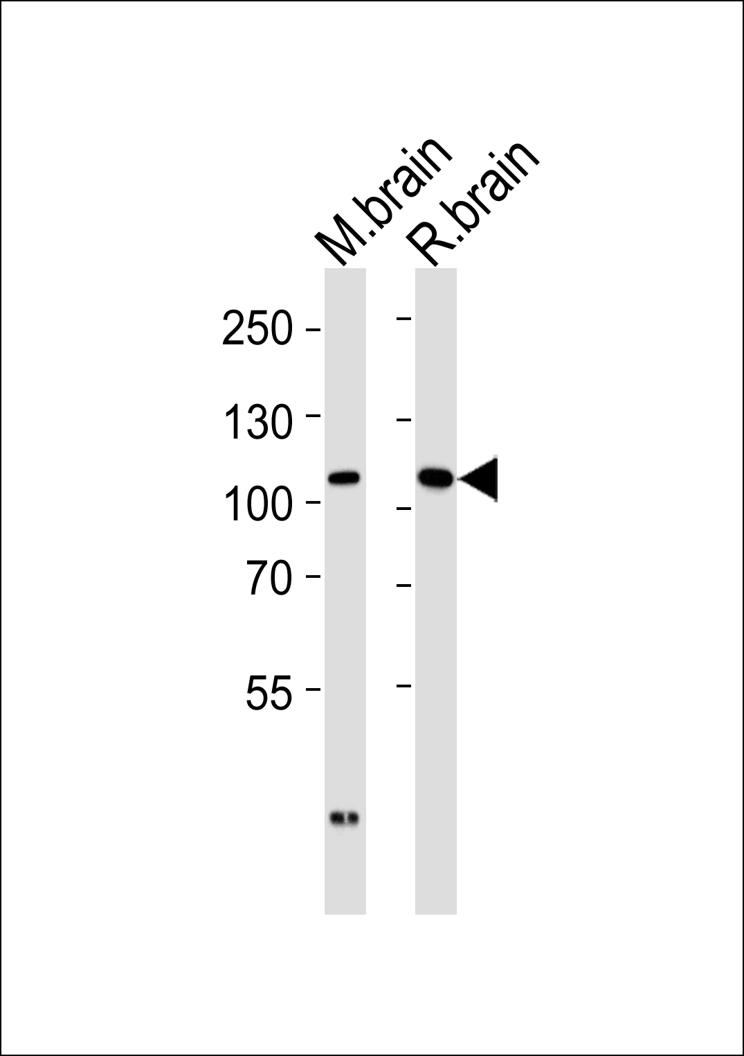 Western blot analysis of tissue lysates from mouse brain and rat brain  (from left to right), using DLG2 Antibody (Center)(Cat.  #AP20636c).  AP20636c was diluted at 1:1000 at each lane.  A goat anti-rabbit IgG H&L(HRP) at 1:5000 dilution was used as the secondary antibody. Lysates at 35ug per lane.