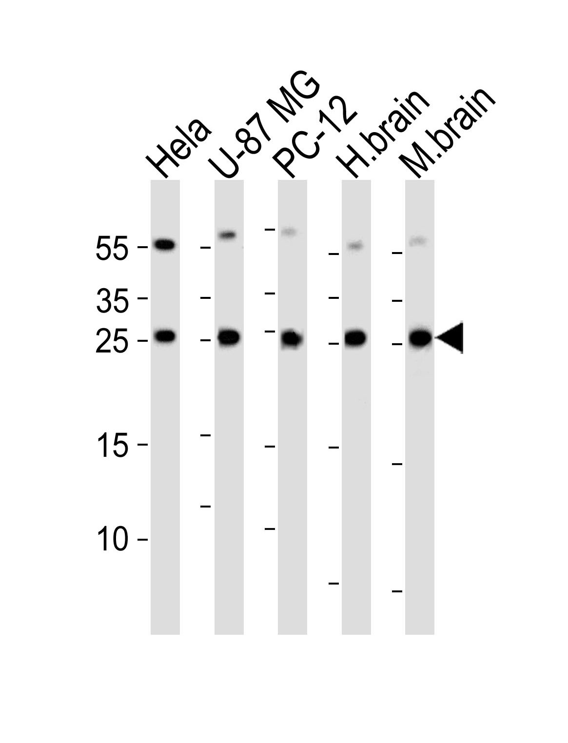 Western blot analysis of lysates from Hela, U-87 MG, rat PC-12 cell line , huamn brain and mouse brain tissue lysate(from left to right), using RAB35 Antibody (C-term)(Cat.  #AP20639c).  AP20639c was diluted at 1:1000 at each lane.  A goat anti-rabbit IgG H&L(HRP) at 1:5000 dilution was used as the secondary antibody. Lysates at 35ug per lane.