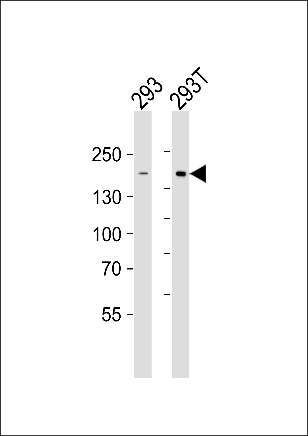 Western blot analysis of lysates from 293, 293T cell line (from left to right), using DIAPH1 Antibody (N-term)(Cat.  #AP20655a).  AP20655a was diluted at 1:1000 at each lane.  A goat anti-rabbit IgG H&L(HRP) at 1:5000 dilution was used as the secondary antibody. Lysates at 35ug per lane.
