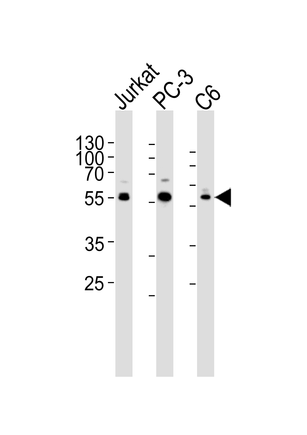 Western blot analysis of lysates from Jurkat, PC-3, C6 cell line (from left to right), using AKT1/2/3 Antibody (Center)(Cat.  #AP20658c).  AP20658c was diluted at 1:1000 at each lane.  A goat anti-rabbit IgG H&L(HRP) at 1:5000 dilution was used as the secondary antibody. Lysates at 35ug per lane.