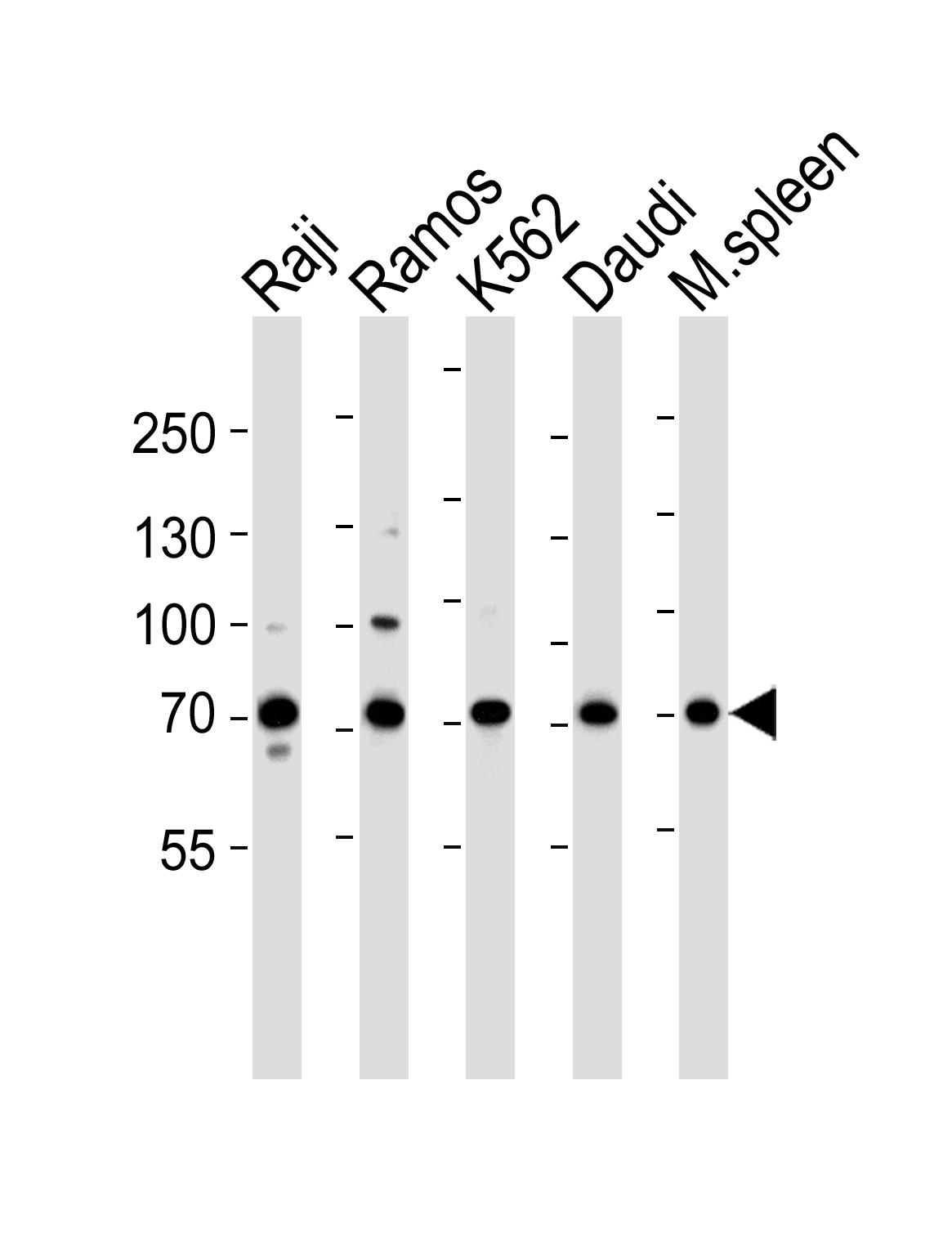 Western blot analysis of lysates from Raji, Ramos, K562, Daudi cell line and mouse spleen tissue lysate(from left to right), using BTK Antibody (Center)(Cat.  #AP20669c).  AP20669c was diluted at 1:1000 at each lane.  A goat anti-rabbit IgG H&L(HRP) at 1:5000 dilution was used as the secondary antibody. Lysates at 35ug per lane.