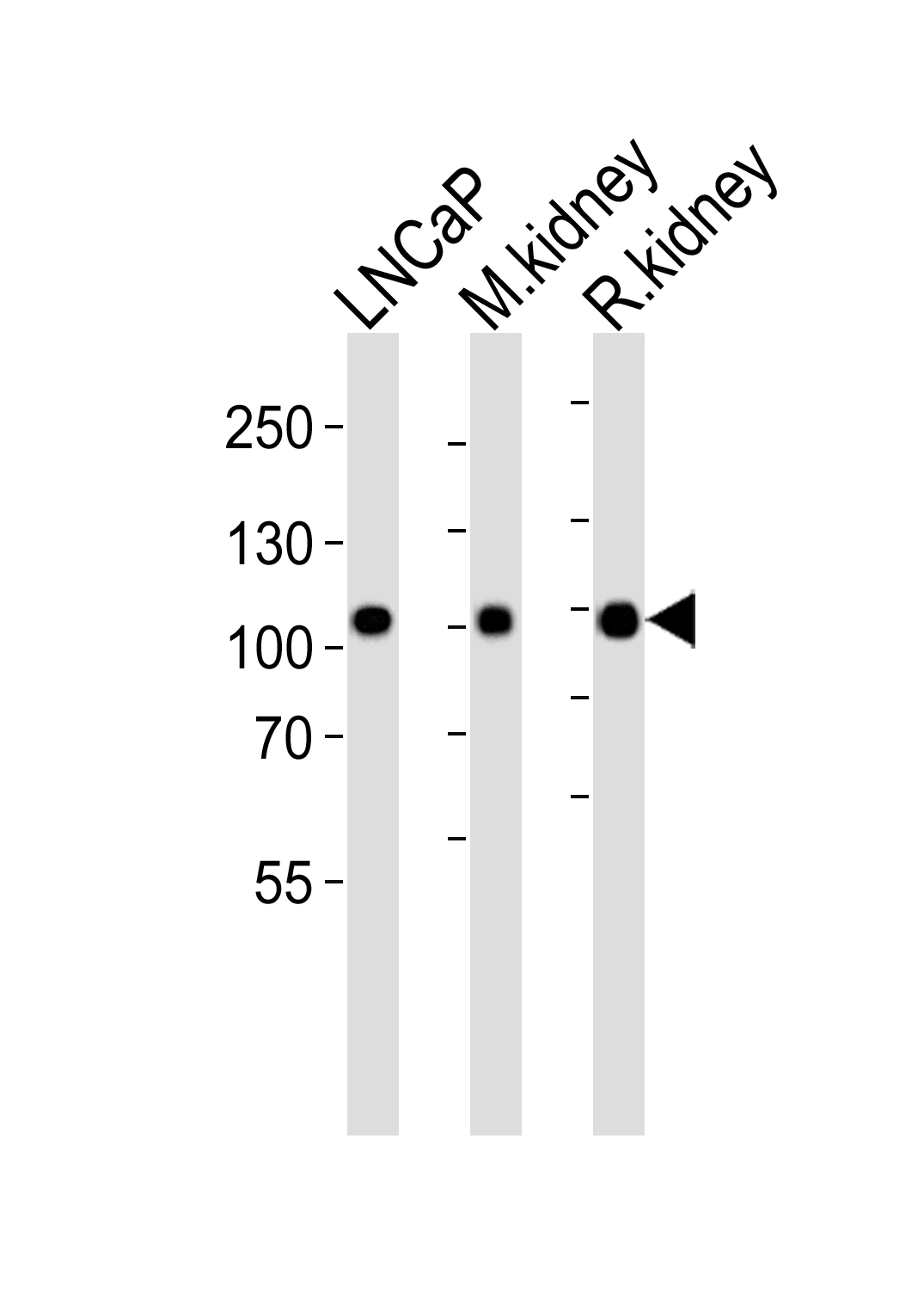 Western blot analysis of lysates from LNCaP cell line, mouse kidney, rat kidney tissue lysate(from left to right), using MME Antibody (Center)(Cat.  #AP20692c).  AP20692c was diluted at 1:1000 at each lane.  A goat anti-rabbit IgG H&L(HRP) at 1:5000 dilution was used as the secondary antibody. Lysates at 35ug per lane.