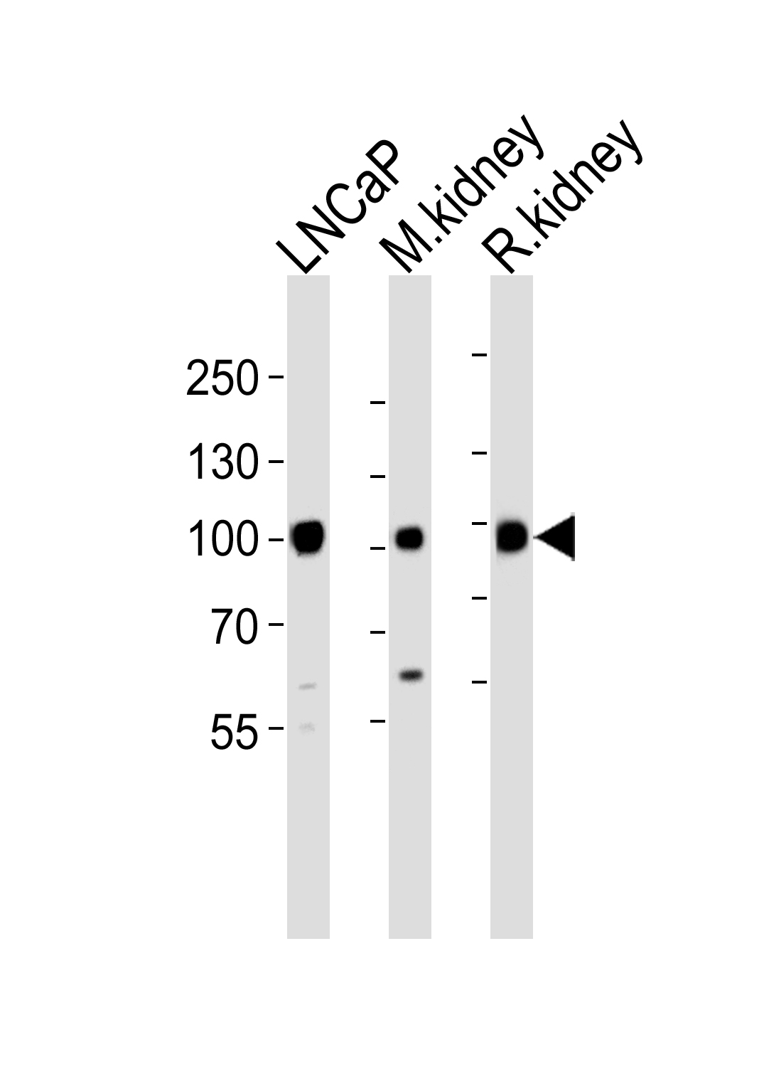 Western blot analysis of lysates from LNCaP, M. kidney, R. kidney cell line (from left to right), using MME Antibody (N-term)(Cat.  #AP20696a).  AP20696a was diluted at 1:1000 at each lane.  A goat anti-rabbit IgG H&L(HRP) at 1:5000 dilution was used as the secondary antibody. Lysates at 35ug per lane.