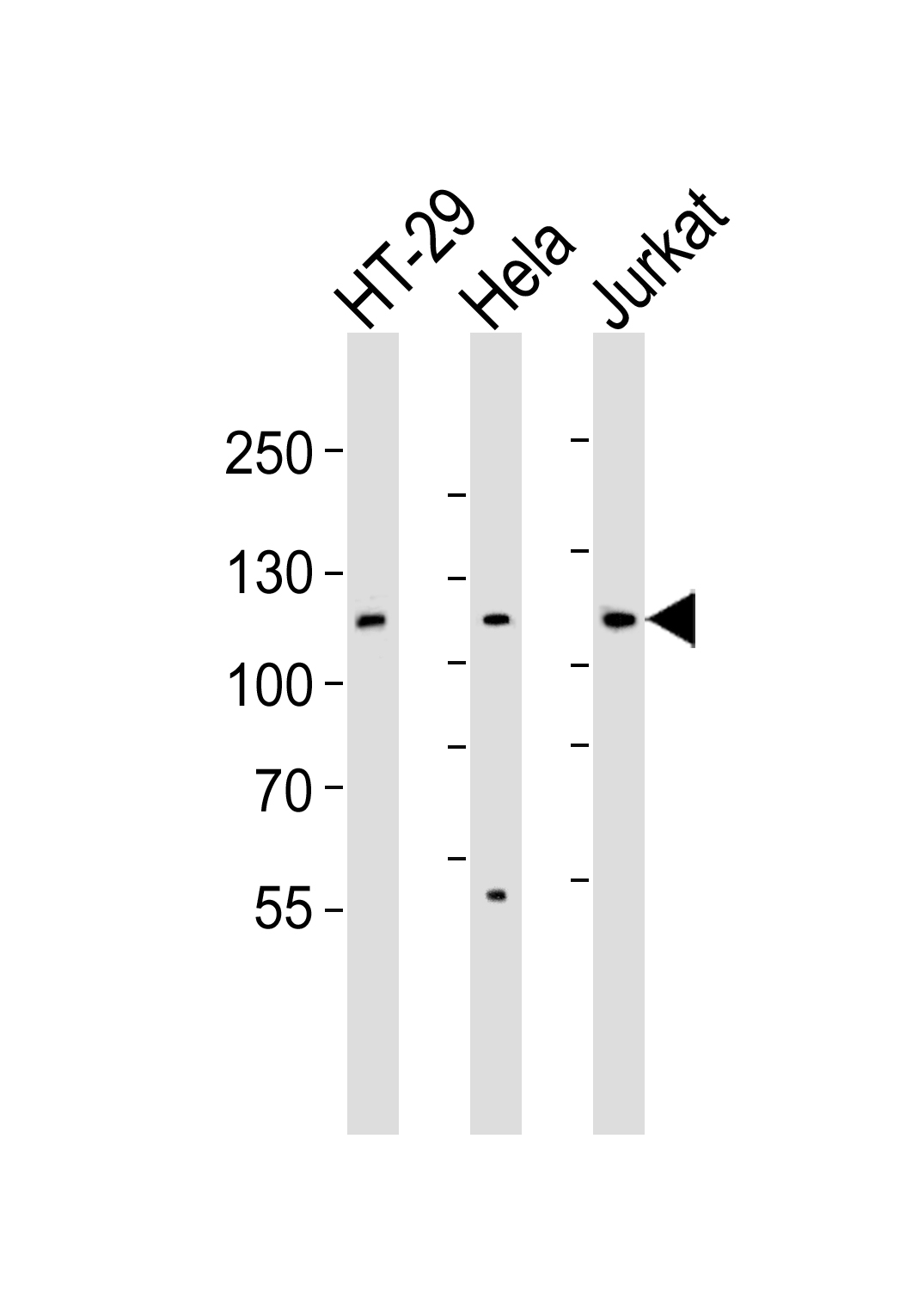 WB - JAK1 Antibody (N-term) AP20699a