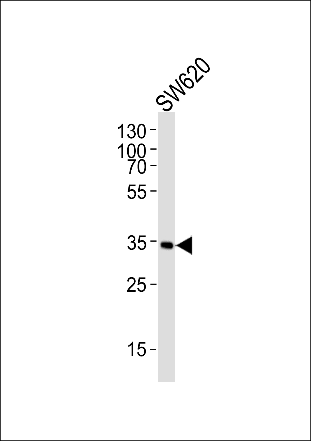 Western blot analysis of lysate from SW620 cell line, using C1QBP Antibody (N-term)(Cat.  #AP20730a).  AP20730a was diluted at 1:1000.  A goat anti-rabbit IgG H&L(HRP) at 1:5000 dilution was used as the secondary antibody. Lysate at 35ug.