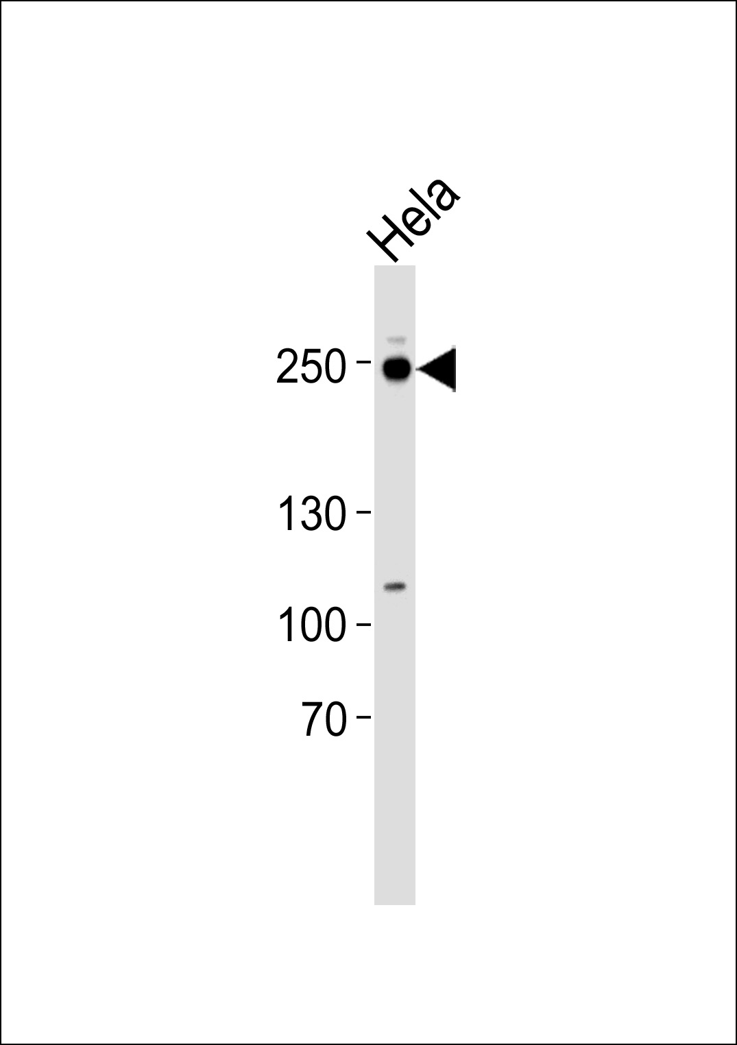 Western blot analysis of lysate from Hela cell line, using RSF1 Antibody (C-term)(Cat.  #AP20734c).  AP20734c was diluted at 1:1000.  A goat anti-rabbit IgG H&L(HRP) at 1:5000 dilution was used as the secondary antibody. Lysate at 35ug.