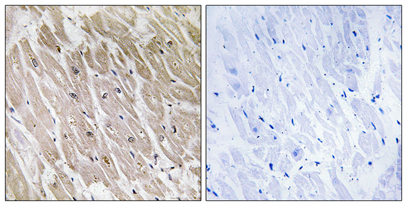 IHC - ACAD10 Antibody AP50759