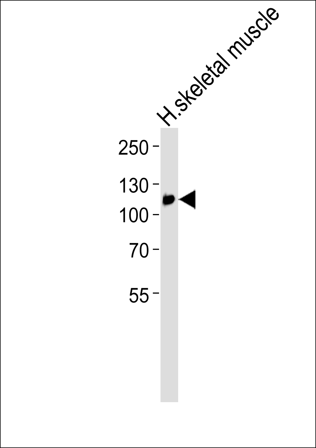 WB - ACAD10 Antibody AP50759