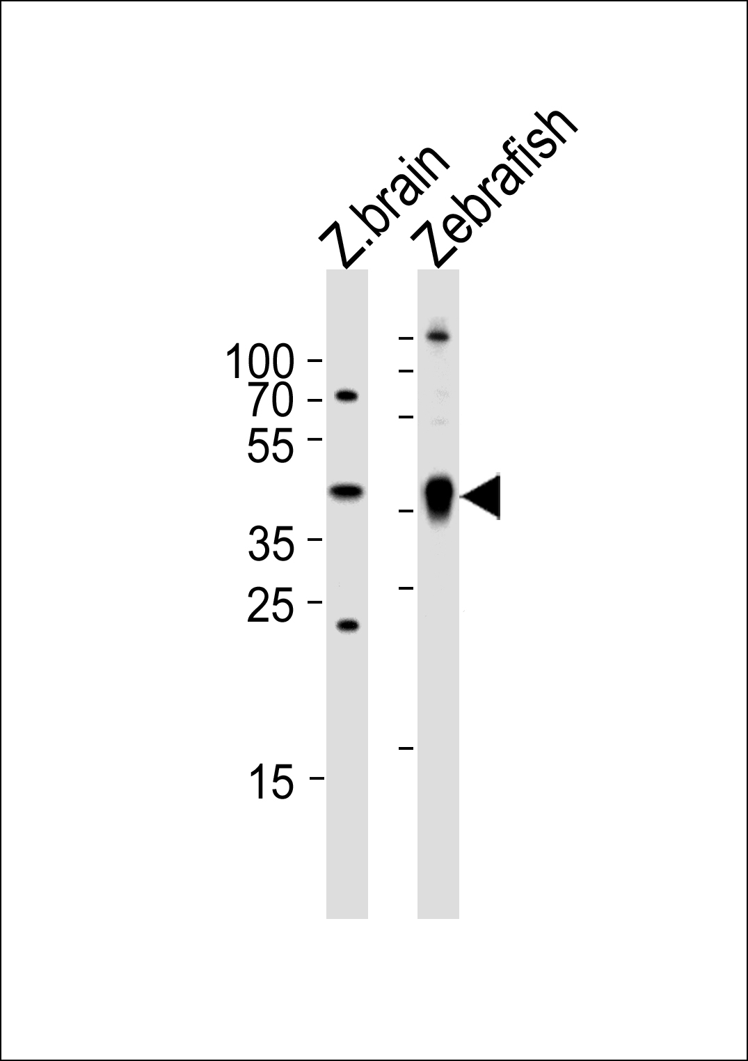 Western blot analysis of lysates from zebra fish brain and Zebrafish tissue lysate (from left to right), using (DANRE) ada Antibody (Center)(Cat.  #Azb18702c).  Azb18702c was diluted at 1:1000 at each lane.  A goat anti-rabbit IgG H&L(HRP) at 1:5000 dilution was used as the secondary antibody. Lysates at 35ug per lane.