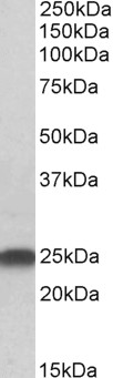 WB - LIN7B / MALS-2 Antibody (N-Term) AF2389a