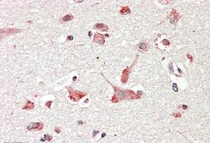 IHC - GOLGA6 / GLP Antibody (internal region) AF2459a