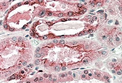 IHC - GGCX Antibody (C-Term) AF2979a