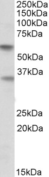 WB - SIGLEC6 Antibody (internal region) AF3285a