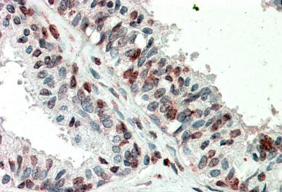 IHC - ZIC3 (aa178-189) Antibody (internal region) AF3500a