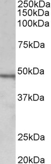 WB - CHIT1 (aa409-423) Antibody (internal region, near C  Terminus) AF3672a