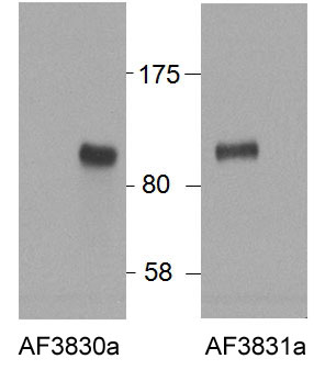 WB - HIC1 (aa396-410) Antibody (internal region) AF3830a