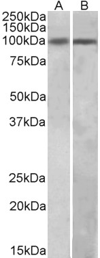 WB - HIC1 (aa396-410) Antibody (internal region) AF3830a