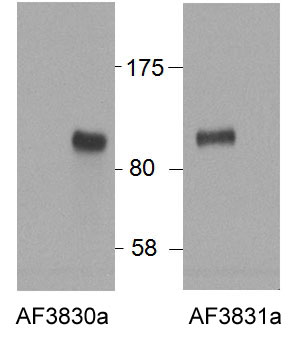 WB - HIC1 (aa193-204) Antibody (internal region) AF3831a
