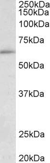 WB - HIC2 (aa188-200) Antibody (internal region) AF3832a