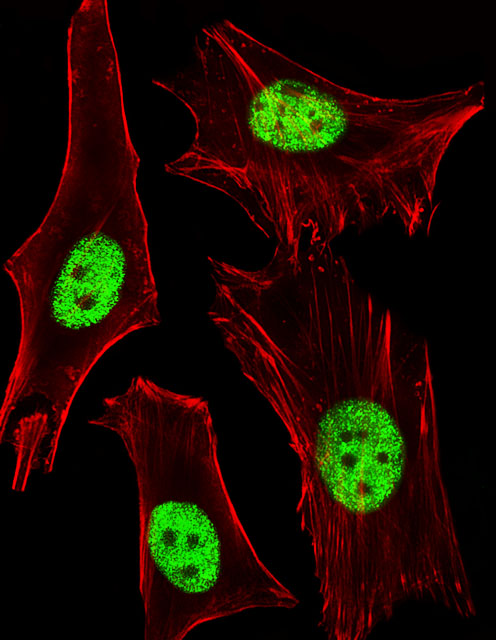 Fluorescent image of Hela cells stained with PPARA Antibody(Cat#AM8425b).  AM8425b was diluted at 1:25 dilution.  An Alexa Fluor� 488-conjugated goat anti-mouse lgG at 1:400 dilution was used as the secondary antibody (green).  Cytoplasmic actin was counterstained with Alexa Fluor� 555 conjugated with Phalloidin (red).