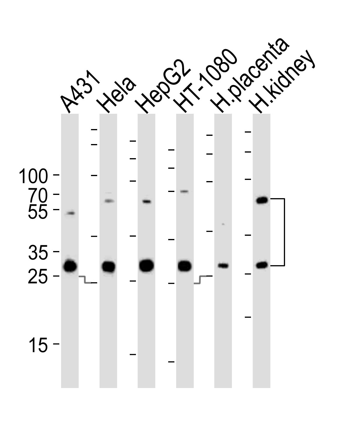 Western blot analysis of lysates from A431, Hela, HepG2, HT-1080 cell line and human placenta, kidney tissue lysate (from left to right), using CTSA Antibody (N-term)(Cat.  #AP10476a).  AP10476a was diluted at 1:1000 at each lane.  A goat anti-rabbit IgG H&L(HRP) at 1:10000 dilution was used as the secondary antibody. Lysates at 35ug per lane.