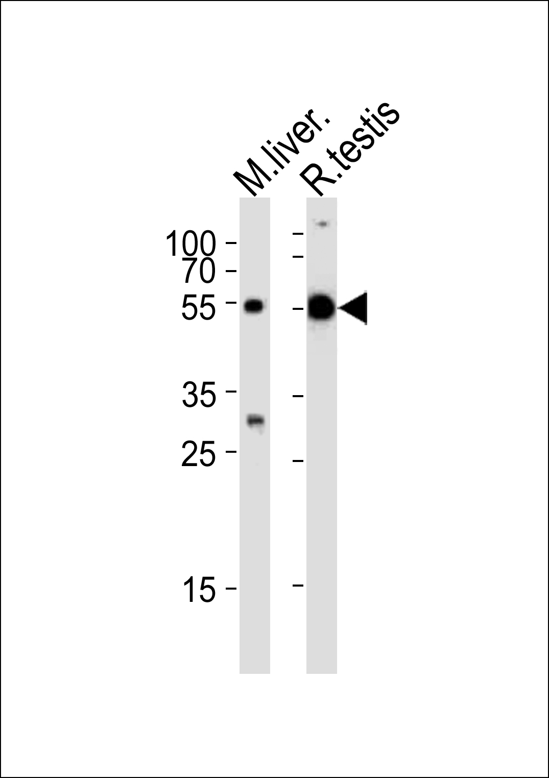WB - TUBA1C Antibody (C-term) AP12043b