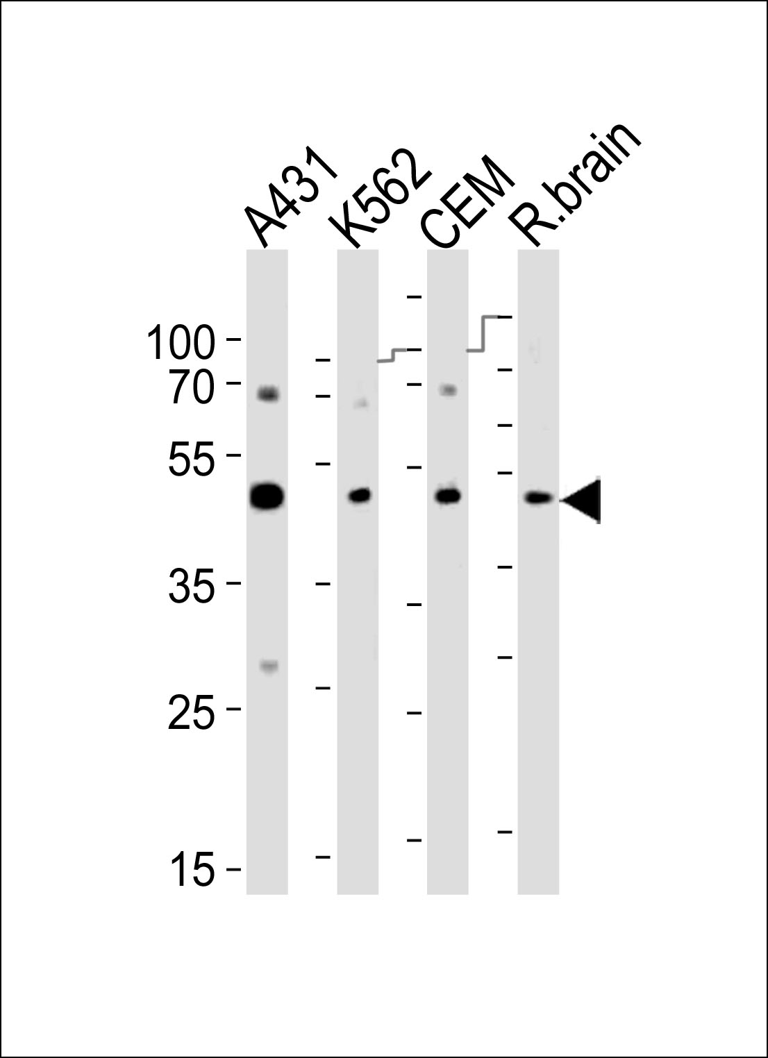 Western blot analysis of lysates from A431, K562, CEM cell line and rat brain tissue lyaste(from left to right), using SUV39H2 Antibody (K315)(Cat.  #AP1281B).  AP1281B was diluted at 1:1000 at each lane.  A goat anti-rabbit IgG H&L(HRP) at 1:10000 dilution was used as the secondary antibody. Lysates at 35ug per lane.