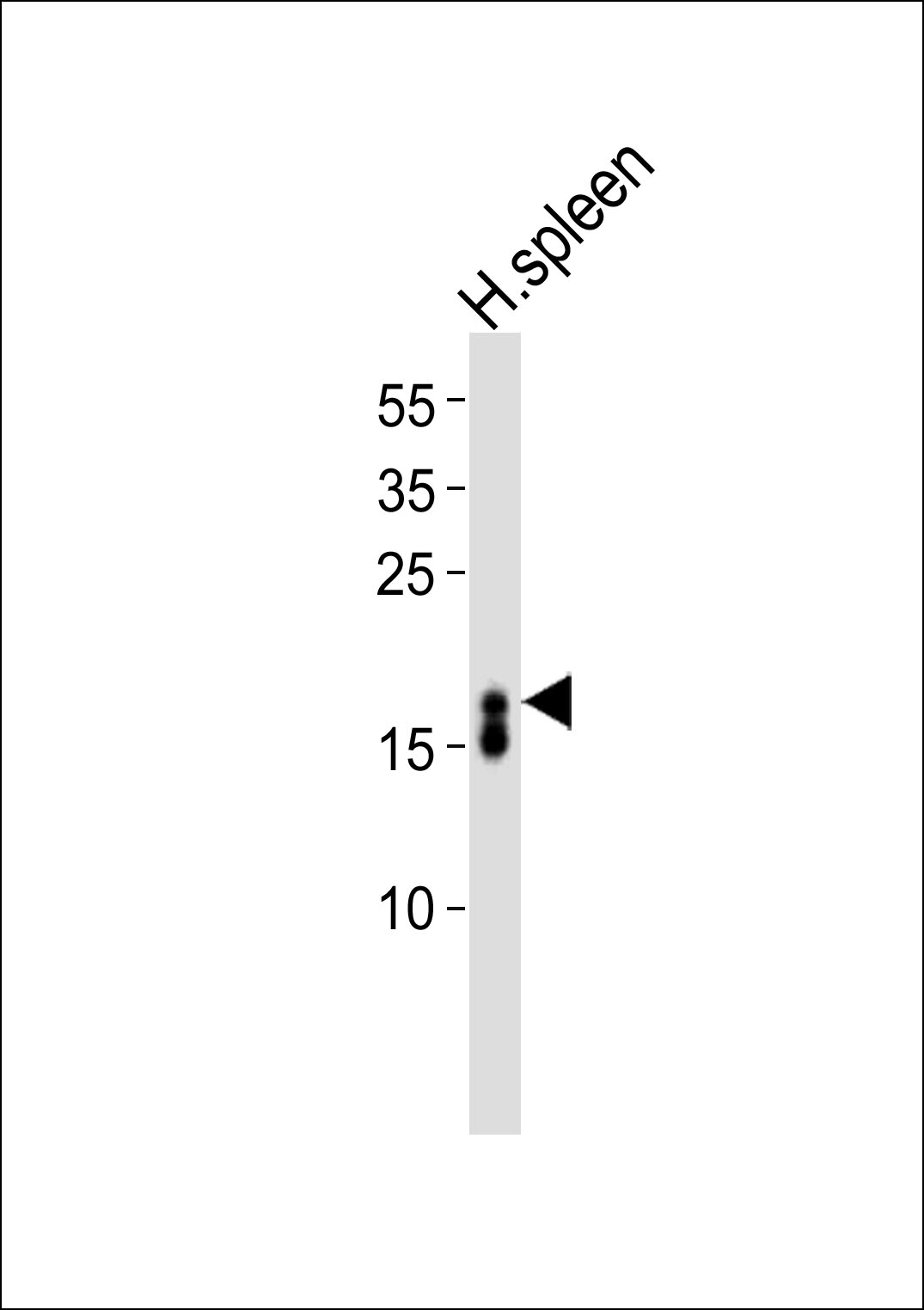 WB - RNASE3 Antibody (C-term) AP13557b