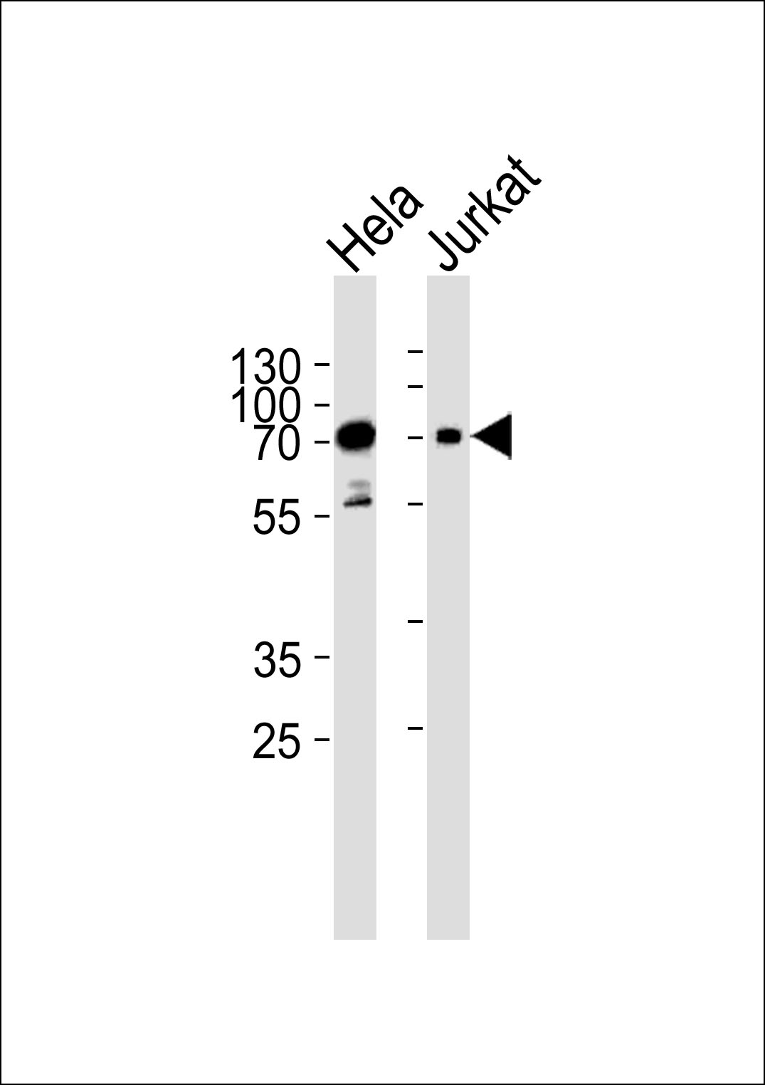 WB - Mouse Pak3 Antibody (N-term) AP13931a