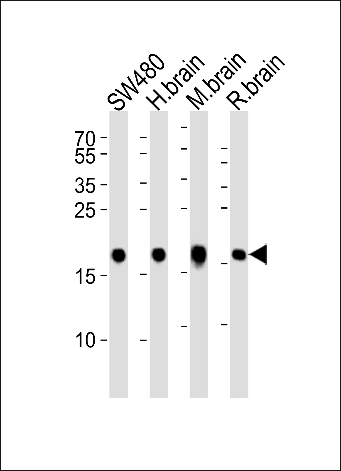 Western blot analysis of lysates from SW480 cell line,  human brain, mouse brain and rat brain tissue lysate(from left to right), using VILIP1 Antibody (C-term)(Cat.  #AP1561a).  AP1561a was diluted at 1:1000 at each lane.  A goat anti-rabbit IgG H&L(HRP) at 1:5000 dilution was used as the secondary antibody. Lysates at 35ug per lane.