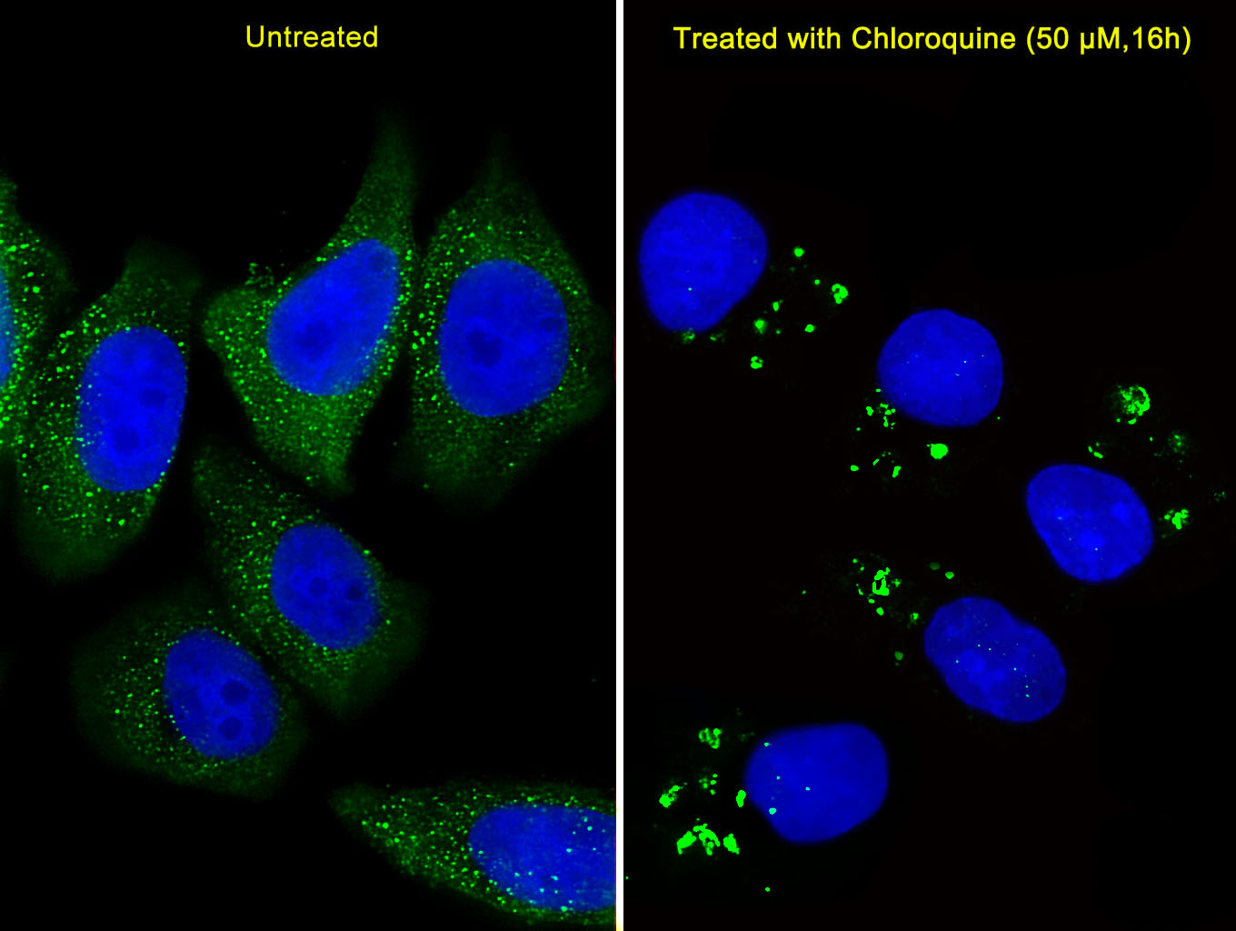 Fluorescent image of U251 cells stained with ATG5 Antibody (C-term) (Cat#AP1812b).  AP1812b was diluted at 1:25 dilution. U251 cells were treated with Chloroquine (50 ?M, 16h),  An Alexa Fluor 488-conjugated goat anti-rabbit lgG at 1:400 dilution was used as the secondary antibody (green).  DAPI was used to stain the cell nuclear (blue).