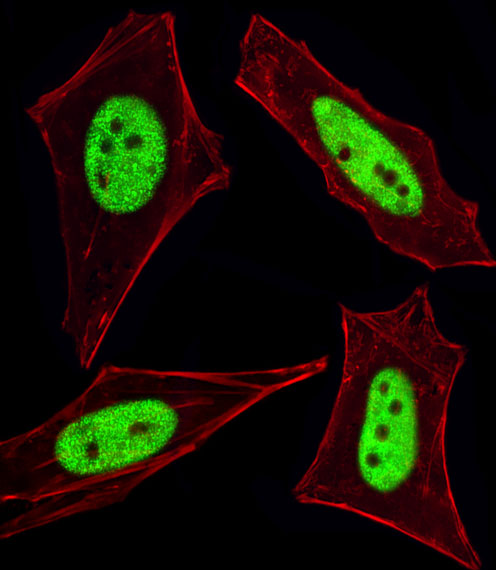 Fluorescent image of HeLa cells stained with Cellular Apoptosis Susceptibility Antibody (N-term) (Cat#AP1935a).  AP1935a was diluted at 1:100 dilution.  An Alexa Fluor 488-conjugated goat anti-rabbit lgG at 1:400 dilution was used as the secondary antibody (green).  Cytoplasmic actin was counterstained with Alexa Fluor� 555 conjugated with Phalloidin (red).