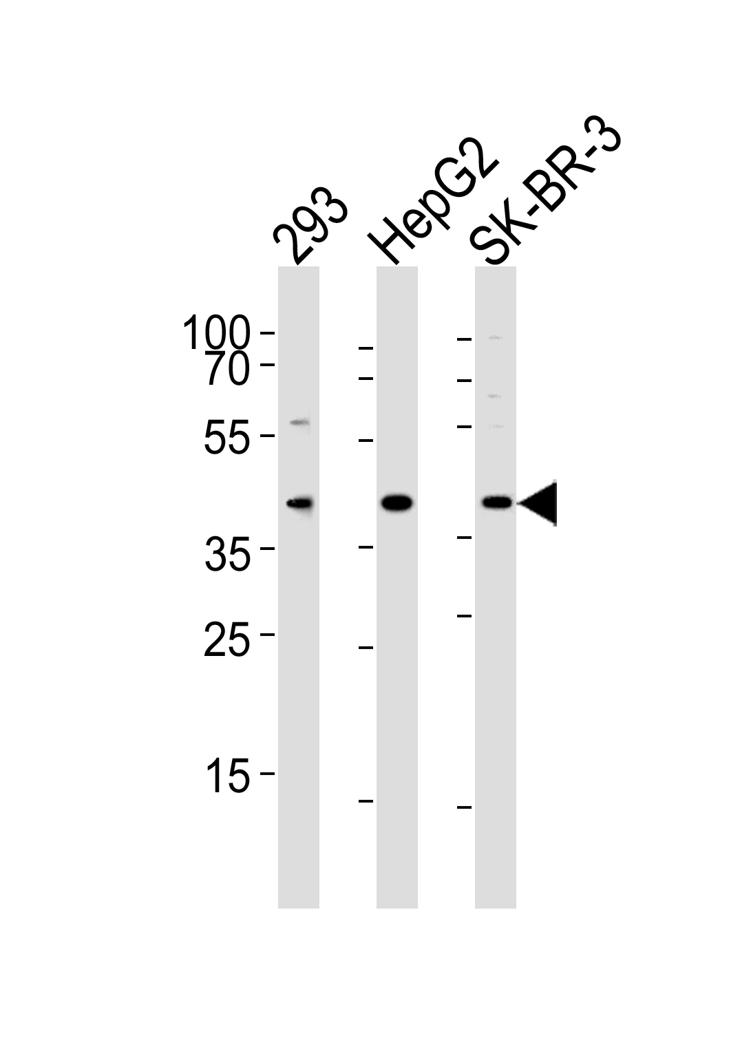 Western blot analysis of lysates from 293, HepG2, SK-BR-3 cell line (from left to right), using ACAT1 Antibody (C-term)(Cat.  #AP20741c).  AP20741c was diluted at 1:1000 at each lane.  A goat anti-rabbit IgG H&L(HRP) at 1:5000 dilution was used as the secondary antibody. Lysates at 35ug per lane.