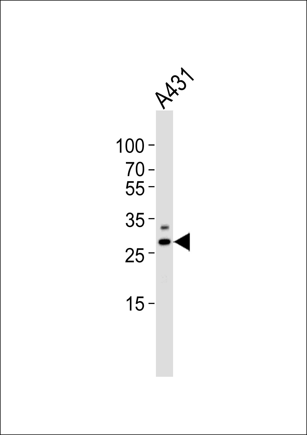 WB - PHB Antibody (N-term) AP20757a