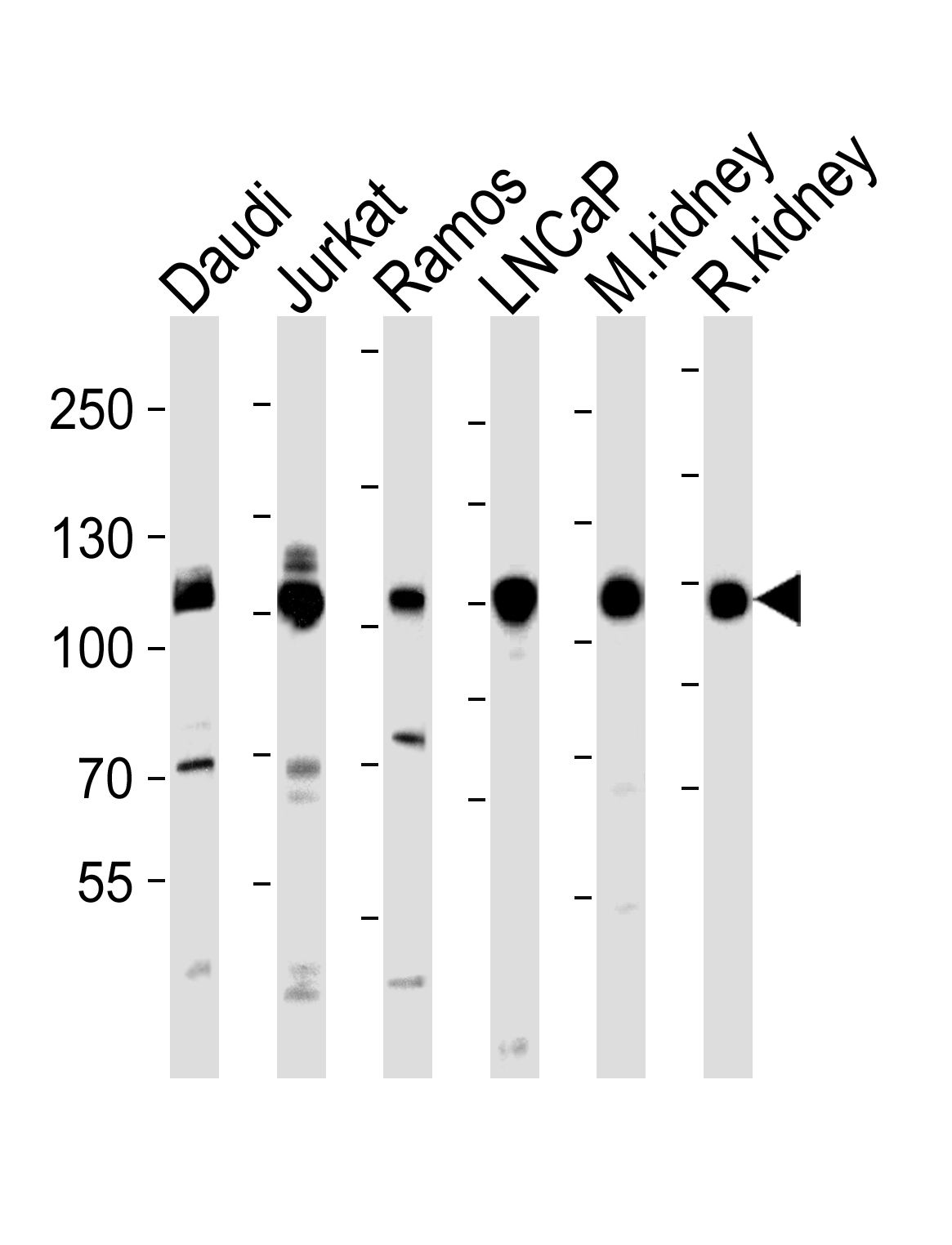 Western blot analysis of lysates from Daudi, Jurkat, Ramos, LNCaP cell line, mouse kidney, rat kidney tissue lysate(from left to right), using MME Antibody (Center)(Cat.  #AP20761c).  AP20761c was diluted at 1:1000 at each lane.  A goat anti-rabbit IgG H&L(HRP) at 1:5000 dilution was used as the secondary antibody. Lysates at 35ug per lane.